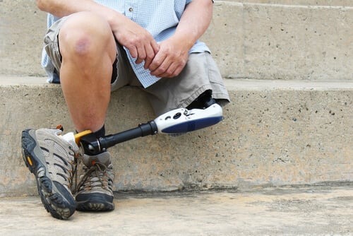 Man with prosthetic leg. Contact our Fort Lauderdale limb amputation lawyers.